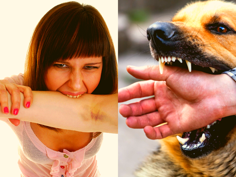 3 choses à faire après une morsure de chien Mémoire Nationale