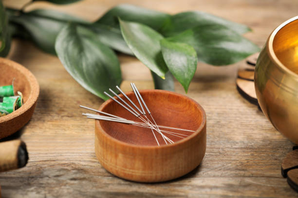 acupuncteur à Bourgoin-Jallieu  