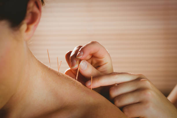 acupuncteur à Bourgoin-Jallieu  